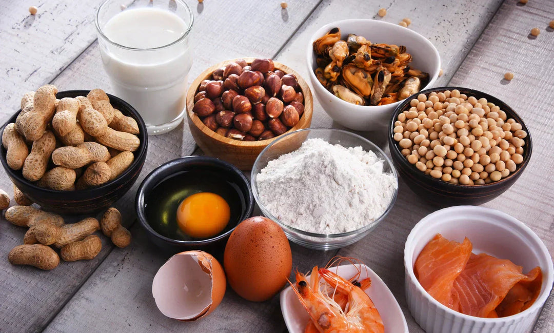 Top allergens